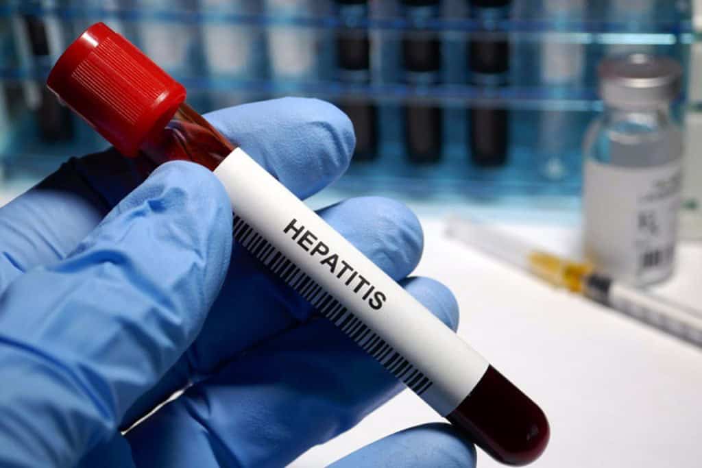 Preocupa el aumento de un tipo de hepatitis aguda en chicos y de origen desconocido