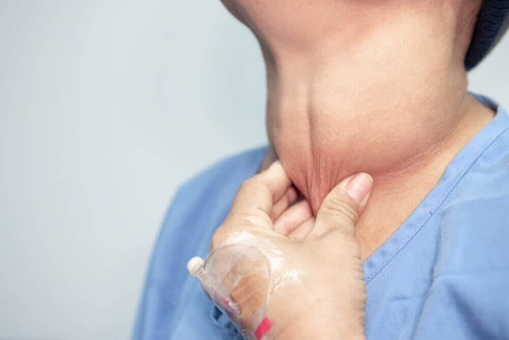 Cada dos horas se detecta un caso de cáncer de tiroides en Argentina