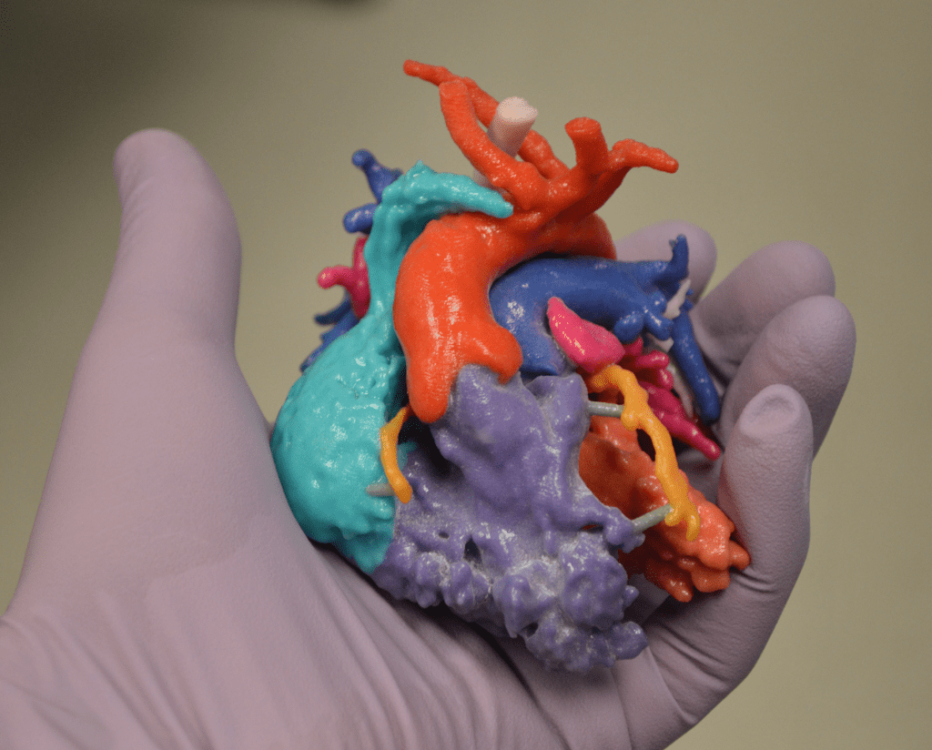 Rady Children’s Hospital develops free software that turns patient data into 3D printable anatomical models