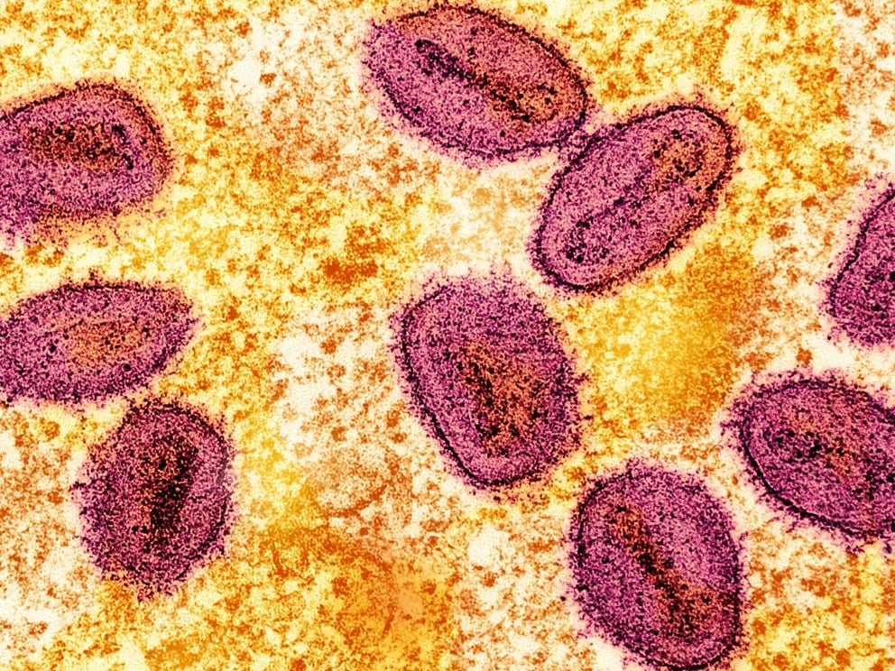 Viruela del mono. Qué se sabe de la nueva cepa más contagiosa y cuáles son los riesgos de una nueva pandemia