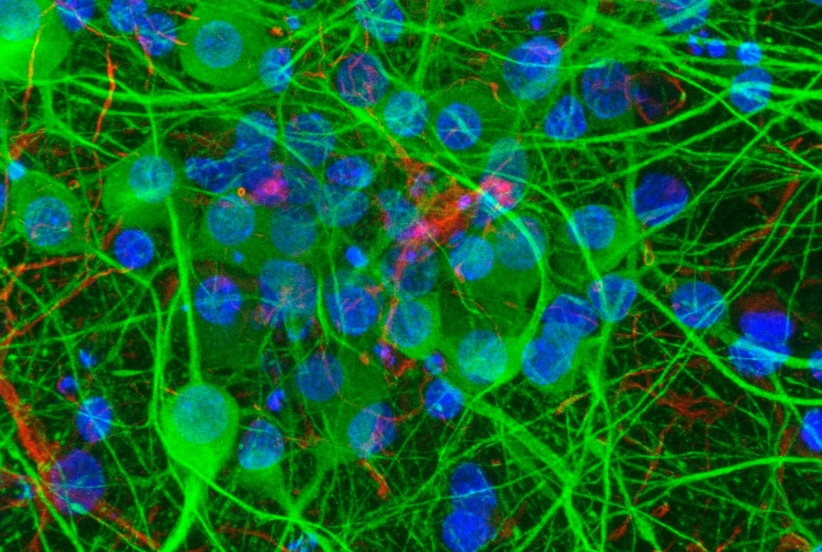 Científicos descubren que bacterias intestinales se comunican directamente con neuronas y abren una nueva era en terapias cerebrales